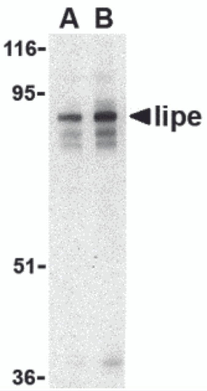Western blot analysis of Lipe in human lymph node tissue lysate with Lipe antibody at (A) 0.5 and (B) 1 &#956;g/mL.