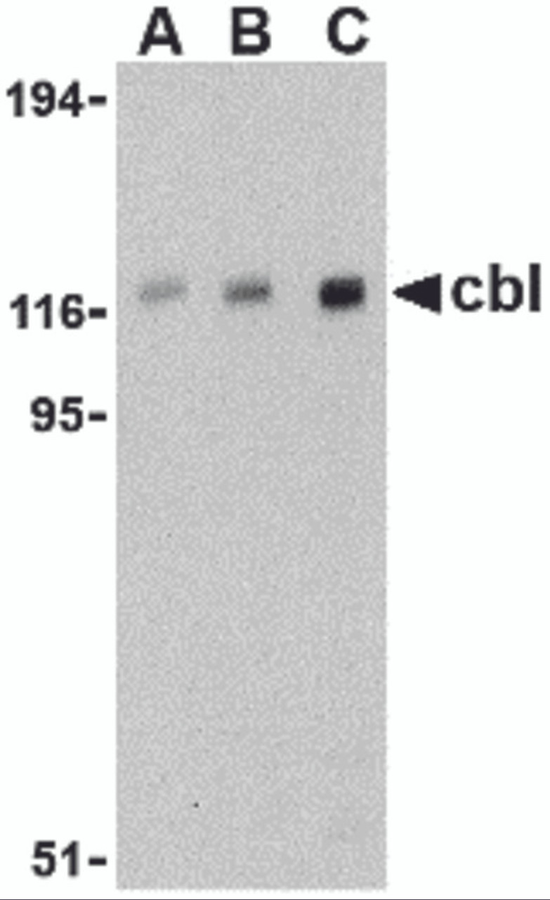 Western blot analysis of cbl in Daudi cell lysate with cbl antibody at (A) 0.5, (B) 1, and (C) 2 &#956;g/mL.