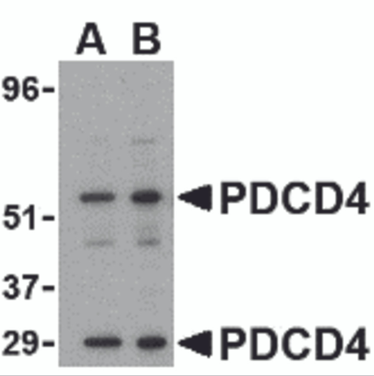 Western blot analysis of PDCD4 in A-20 cell lysate with PDCD4 antibody at (A) 0.5 and (B) 1&#956;g/mL.