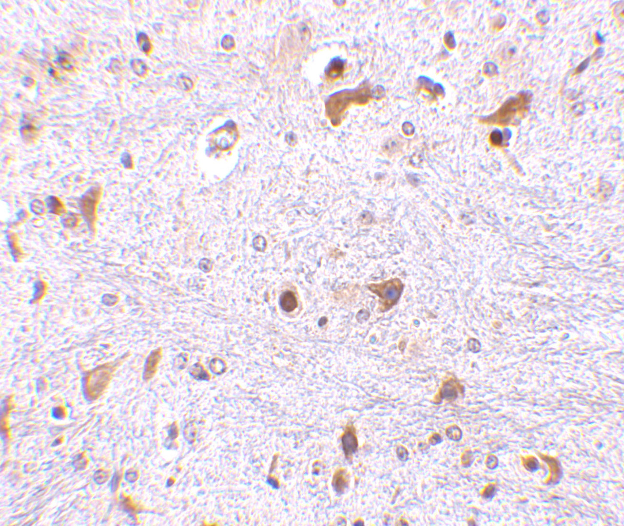 Immunohistochemistry of PDCD4 in mouse brain tissue with PDCD antibody at 2.5 ug/mL.