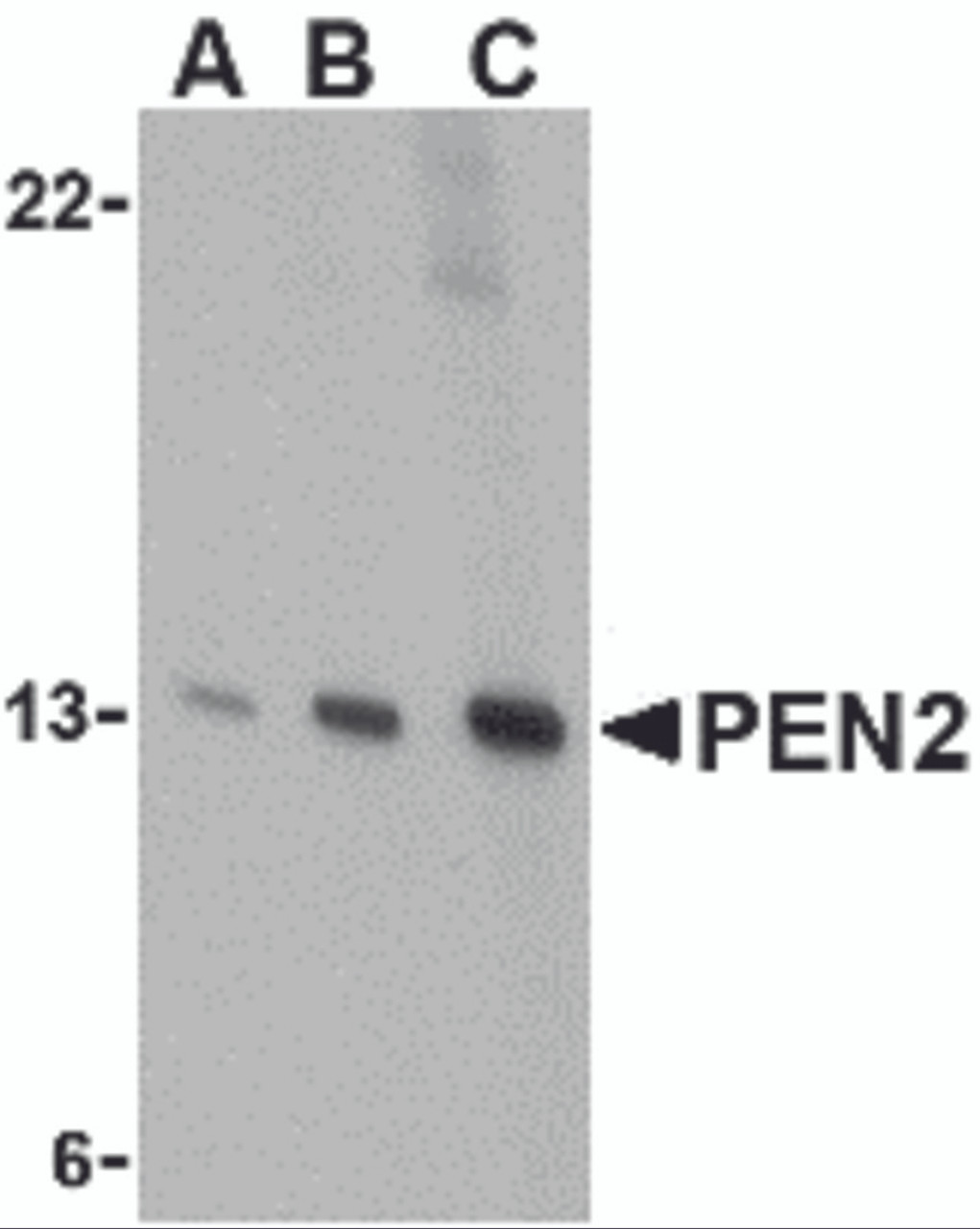 Western blot analysis of PEN2 in K562 cell lysate with PEN2 antibody at (A) 0.5, (B) 1, and (C) 2 &#956;g/mL.