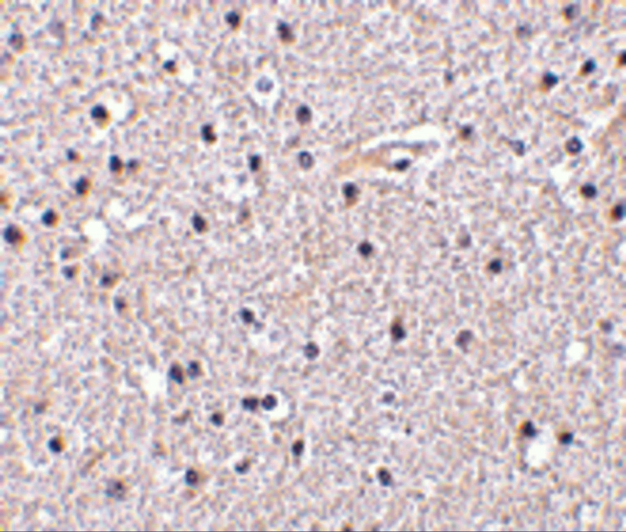 Immunohistochemistry of Nicastrin in human brain tissue with Nicastrin antibody at 5 ug/mL.