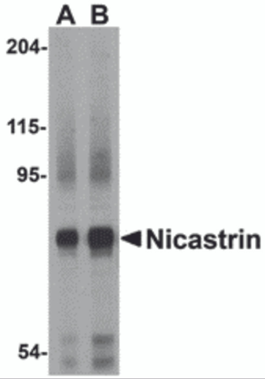 Western blot analysis of Nicastrin in human brain tissue lysate with Nicastrin antibody at (A) 0.5 and (B) 1&#956;g/mL.