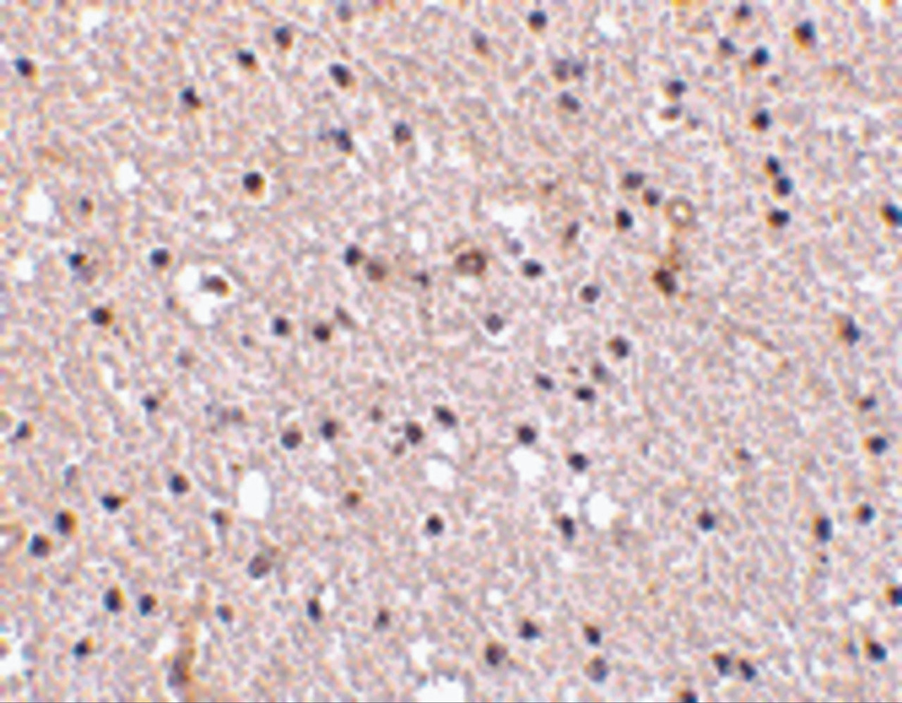 Immunohistochemistry of Nicastrin in human brain tissue with Nicastrin antibody at 2.5 ug/mL.