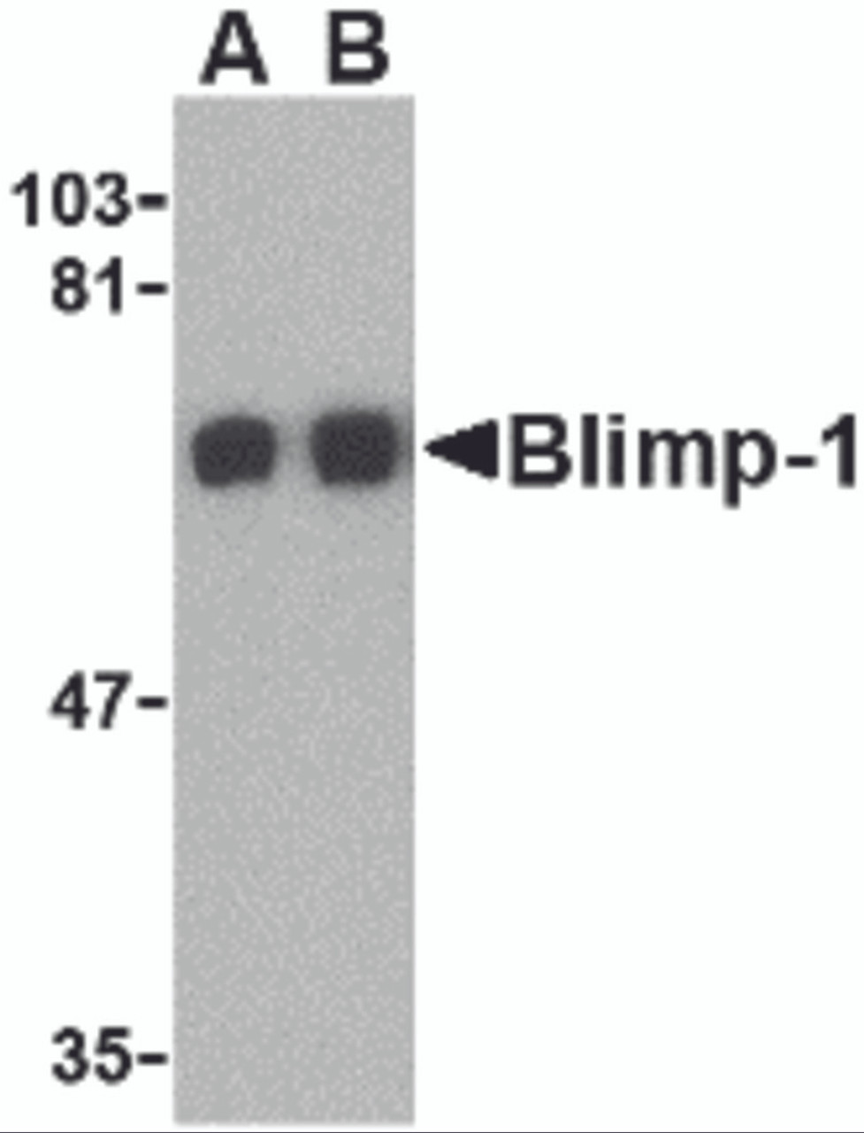 Western blot analysis of Blimp-1 in A549 cell lysate with Blimp-1 antibody at (A) 0.5 and (B) 1&#956;g/mL.