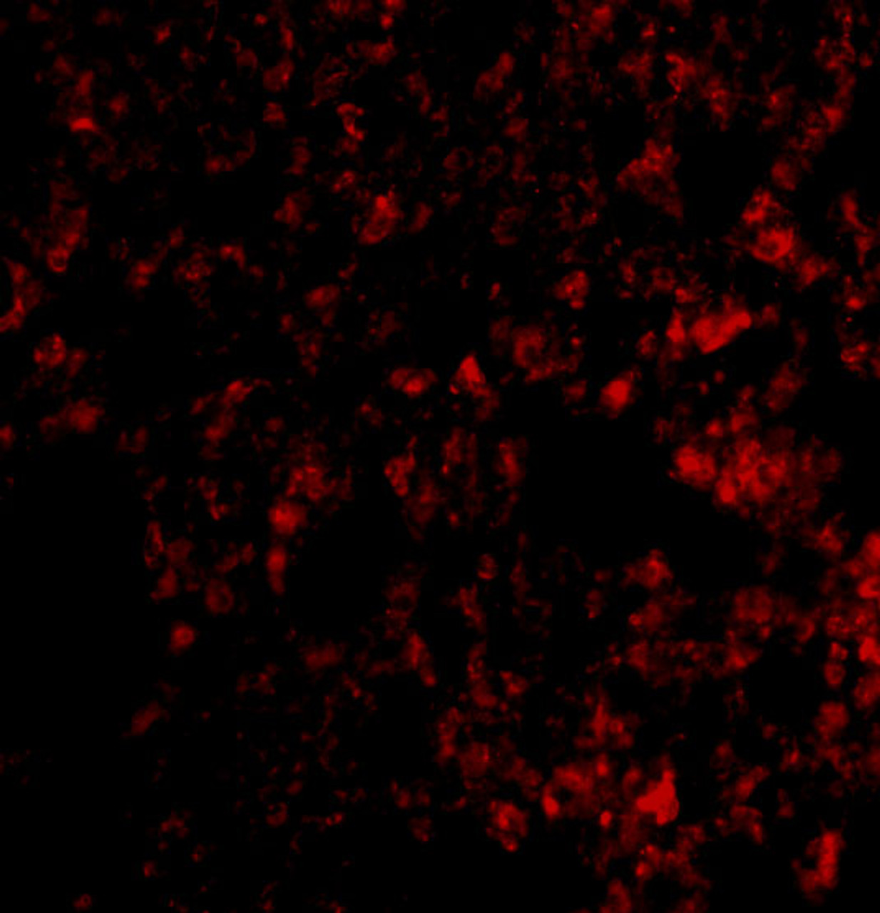 Immunofluorescence of Blimp-1 in mouse lung tissue with Blimp-1 antibody at 20 ug/mL.