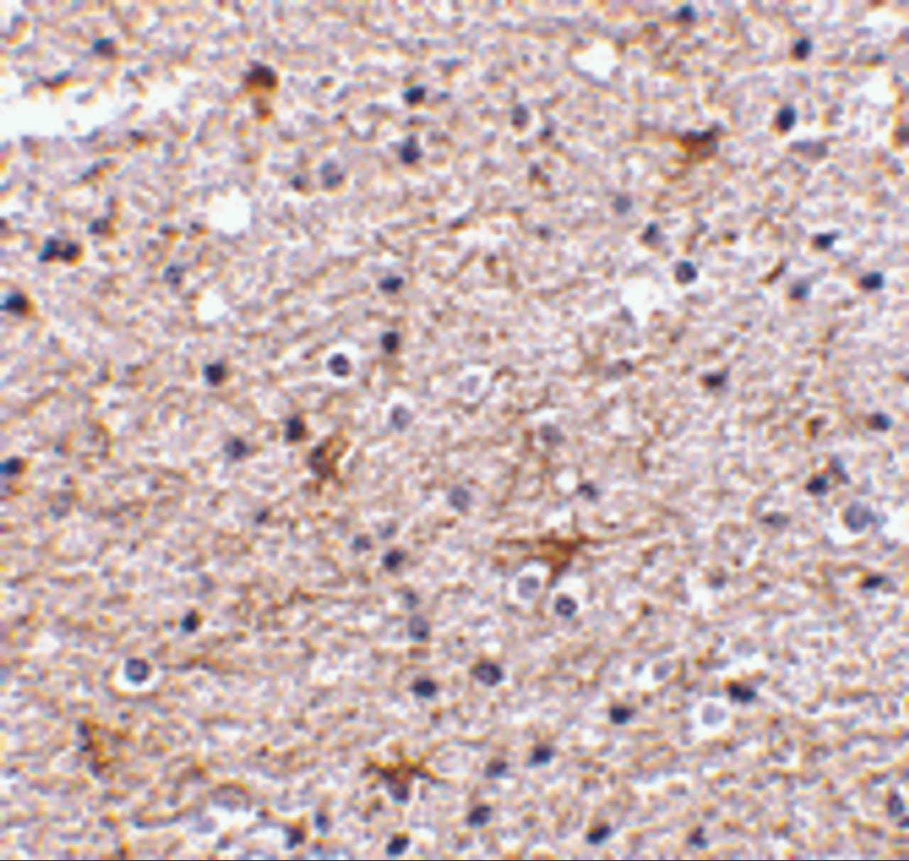 Immunohistochemistry of TMP21 in human brain tissue with TMP21 antibody at 2.5 ug/mL.