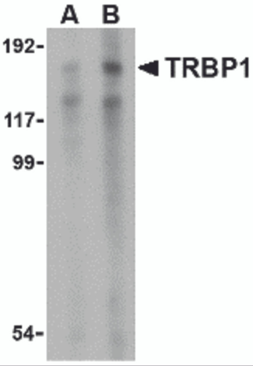 Western blot analysis of TRBP1 in 3T3 cell lysate with TRBP1 antibody at (A) 1 and (B) 2 &#956;g/mL.