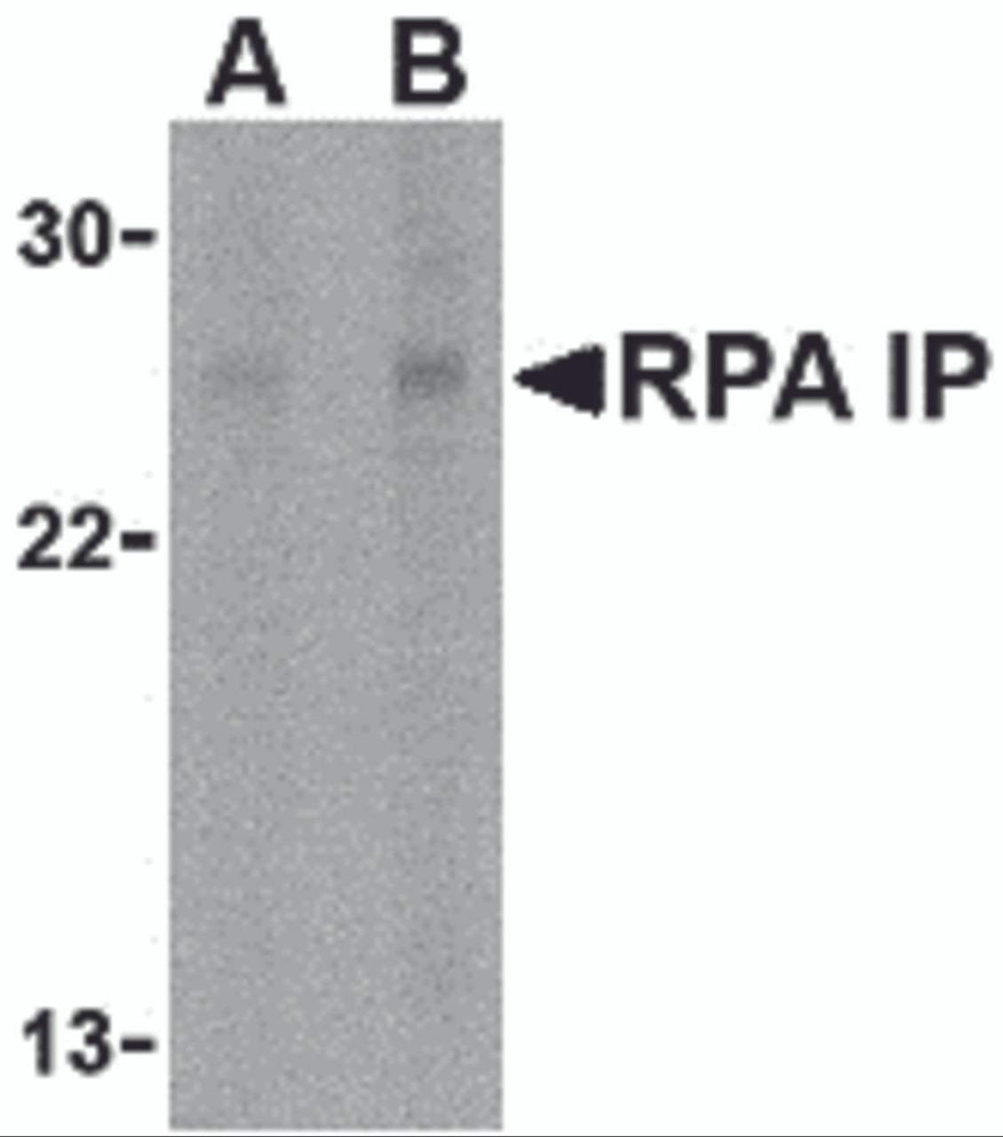 Western blot analysis of RPA Interacting Protein in Jurkat cell lysate with RPA Interacting Protein antibody at (A) 1 and (B) 2 &#956;g/mL.