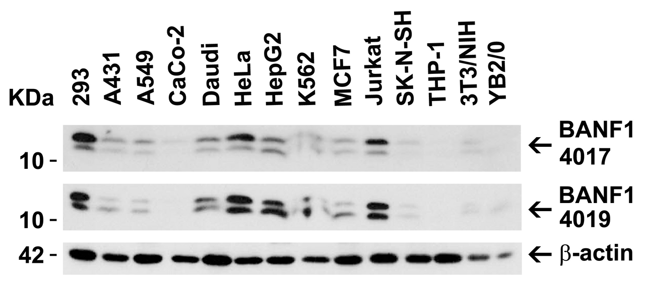 Figure 1 Independent Antibody Validation (IAV) via Protein Expression Profile in Human, Mouse and Rat Cell Lines
Loading: 15 &#956;g of lysates per lane.
Antibodies: BANF1 4017 (2 &#956;g/mL) , BANF1 4019 (2 &#956;g/mL) and beta-actin (1.5 &#956;g/mL) , 1h incubation at RT in 5% NFDM/TBST.
Secondary: Goat anti-rabbit IgG HRP conjugate at 1:10000 dilution.