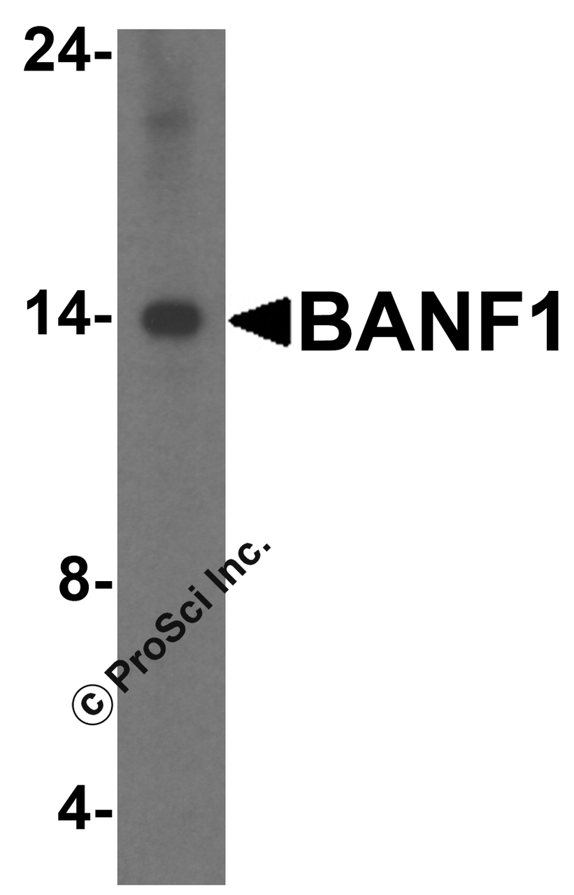 Figure 2 Western Blot Validation in HeLa Cell Lysate
Loading: 15 ug of lysates per lane.
Antibodies: BANF1 4019 (1 ug/mL) , 1h incubation at RT in 5% NFDM/TBST.
Secondary: Goat anti-rabbit IgG HRP conjugate at 1:10000 dilution.