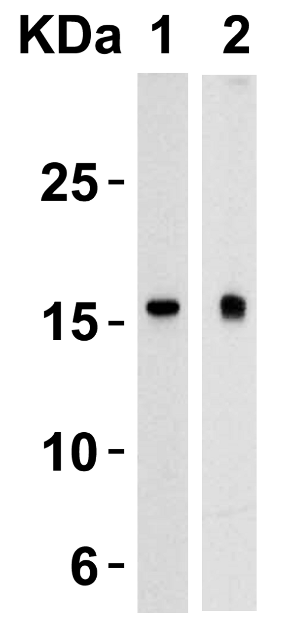 Figure 1 Western Blot Validation in Human Heart (Lane 1) and Human Prostate (Lane 2) 
Loading: 15 &#956;g of lysates per lane.
Antibodies: TSLP 4023 (4 &#956;g/mL) , 1h incubation at RT in 5% NFDM/TBST.
Secondary: Goat anti-rabbit IgG HRP conjugate at 1:10000 dilution.