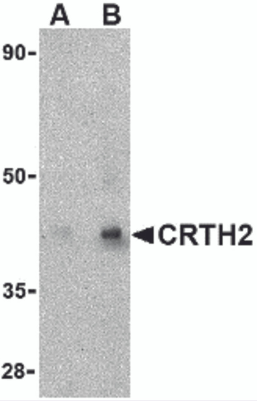 Western blot analysis of CRTH2 in human heart tissue lysate with CRTH2 antibody at (A) 1 and (B) 2 &#956;g/mL.