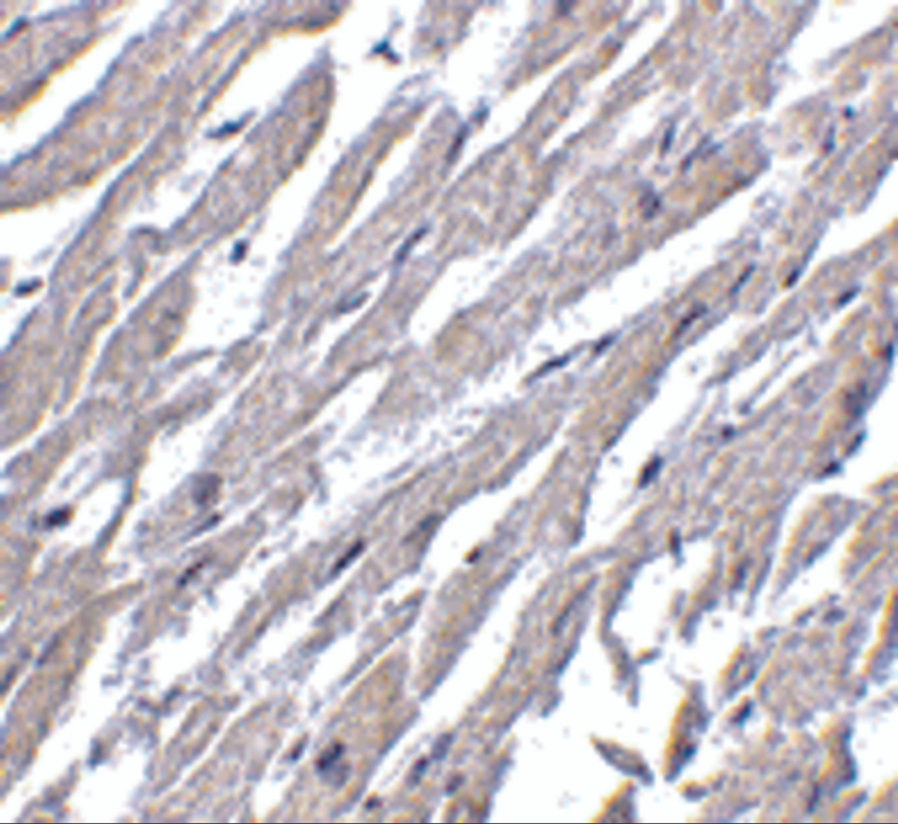 Immunohistochemistry of CRTH2 in human heart tissue with CRTH2 antibody at 2.5 ug/mL.