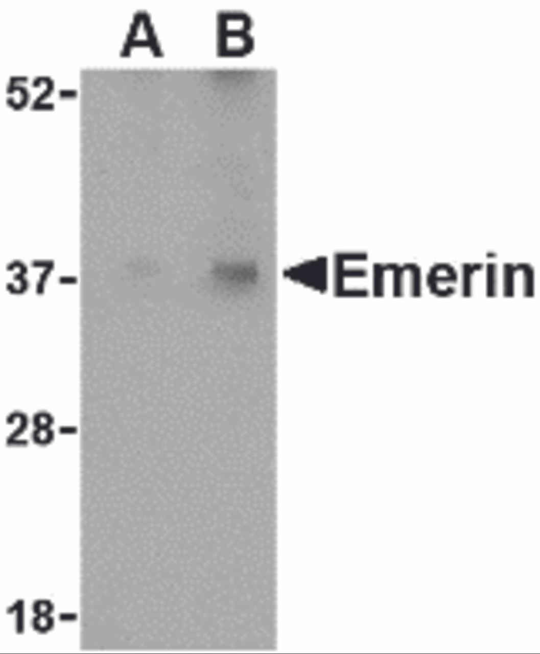 Western blot analysis of Emerin in human skeletal muscle tissue lysate with Emerin antibody at (A) 0.5 and (B) 1 &#956;g/mL.