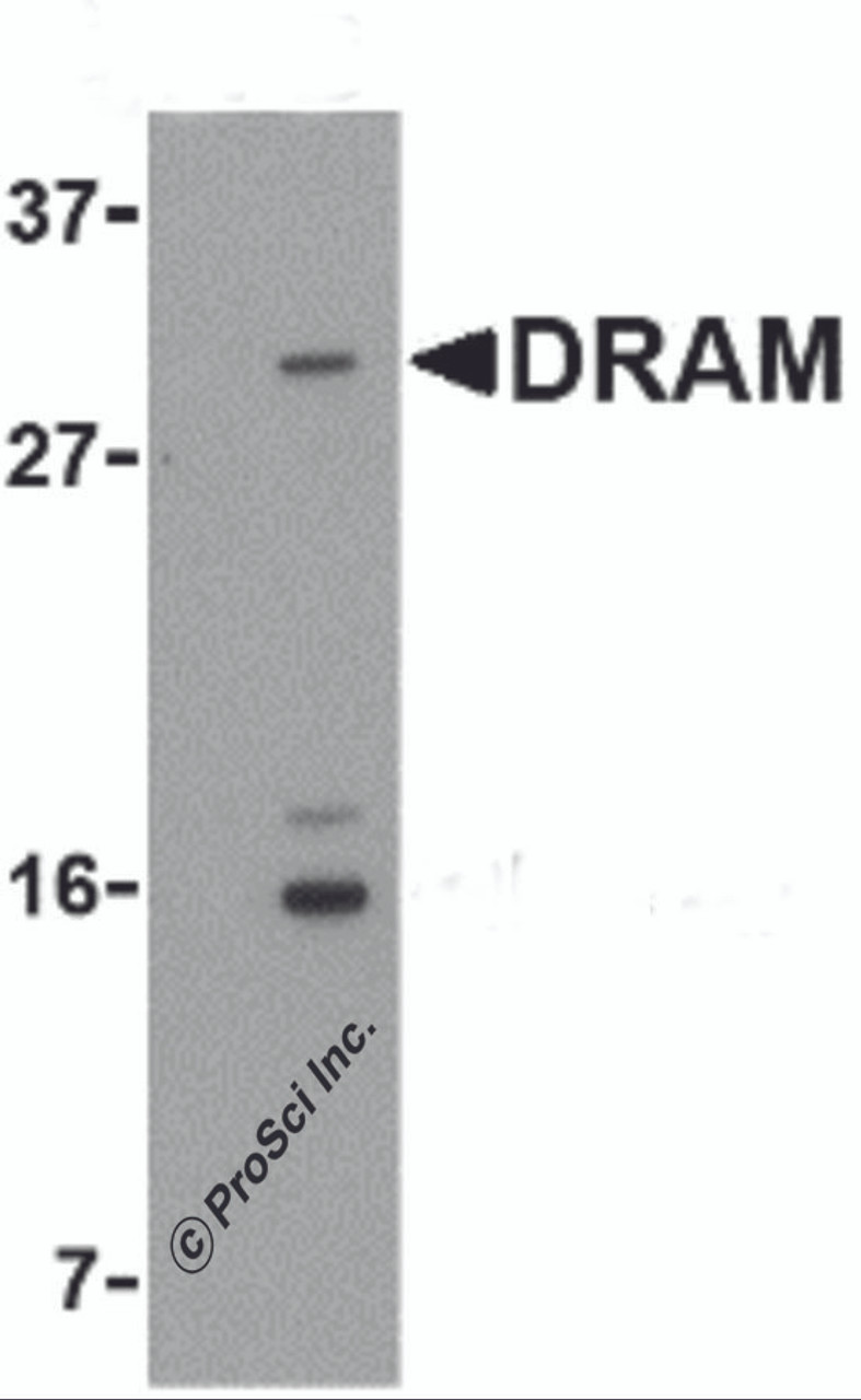 Figure 1 Western Blot Validation in Human 293 Cell Lysate
Loading: 15 &#956;g of lysate per lane.
Antibodies: DRAM 4033 (1 &#956;g/mL) , 1h incubation at RT in 5% NFDM/TBST.
Secondary: Goat anti-rabbit IgG HRP conjugate at 1:10000 dilution.