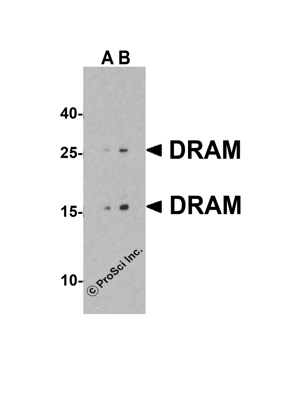 Figure 1 Western Blot Validation in Human 293 Cell Lysate
Loading: 15 &#956;g of lysate per lane.
Antibodies: DRAM 4035 (A: 1 &#956;g/mL, B: 2 &#956;g/mL) , 1h incubation at RT in 5% NFDM/TBST.
Secondary: Goat anti-rabbit IgG HRP conjugate at 1:10000 dilution.