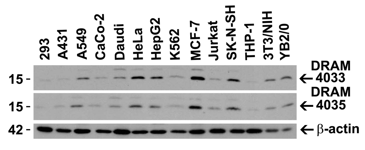 Figure 2 Independent Antibody Validation (IAV) via Protein Expression Profile in Cell Lines
Loading: 15 ug of lysates per lane.
Antibodies: DRAM 4033 (0.5 ug/mL) , DRAM 4035 (2 ug/mL) , beta-actin (1 ug/mL) and GAPDH (0.02 ug/mL) , 1h incubation at RT in 5% NFDM/TBST.
Secondary: Goat anti-rabbit IgG HRP conjugate at 1:10000 dilution.