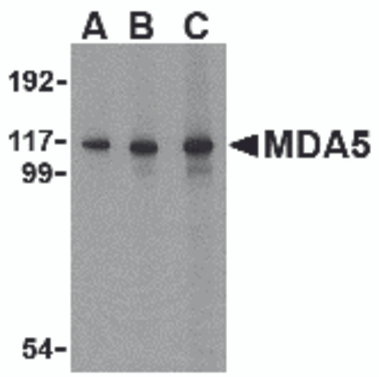 Western blot analysis of MDA5 in Daudi cell lysate with MDA5 antibody at (A) 1, (B) 2 and (C) 4 &#956;g/mL.