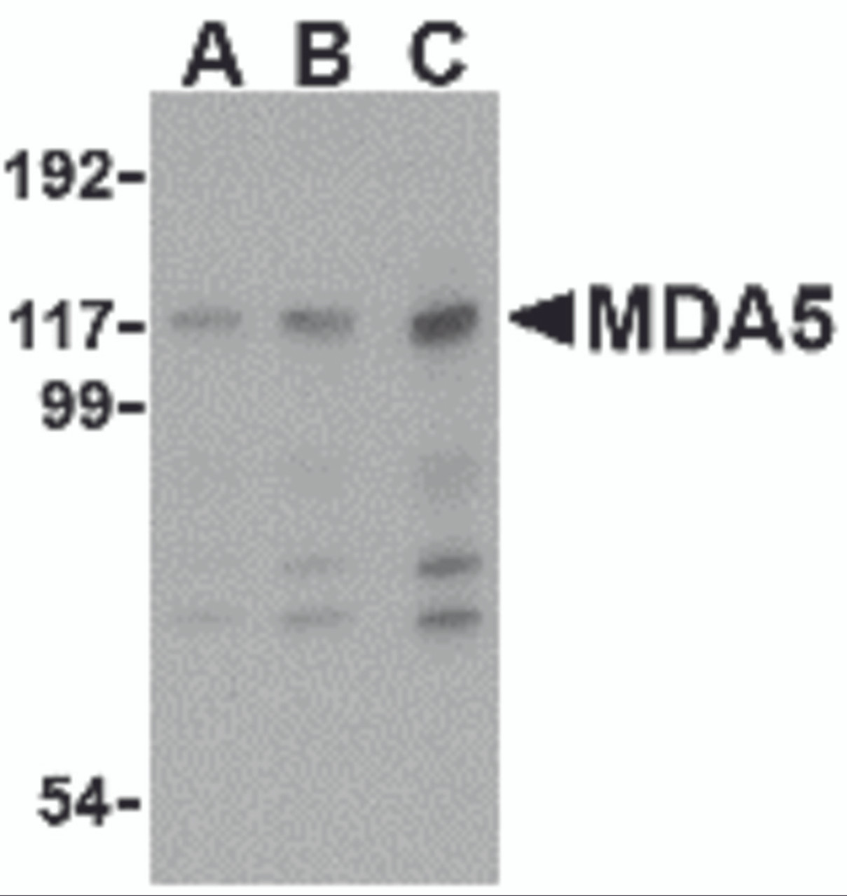 Western blot analysis of MDA5 in Daudi cell lysate with MDA5 antibody at (A) 1, (B) 2 and (C) 4 &#956;g/mL.