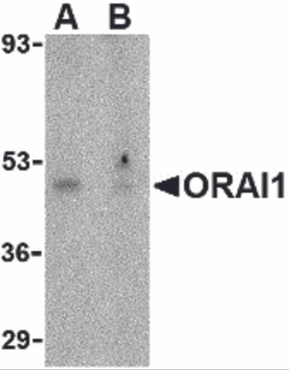 Western blot analysis of ORAI1 in human ovary tissue lysate with ORAI1 antibody at 1 &#956;g/mL in the (A) absence or (B) presence of blocking peptide.