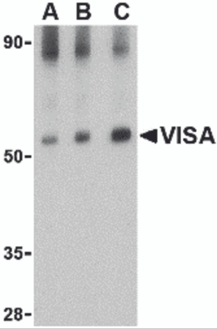 Western blot analysis of VISA in rat brain tissue lysate with VISA antibody at (A) 0.5, (B) 1 and (C) 2 &#956;g/mL.