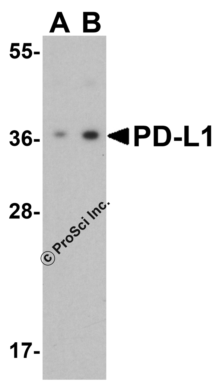 Figure 1 Western Blot Validation of PD-L1 in HeLa Cells
Loading: 15 &#956;g of lysates per lane.
Antibodies: 4059 (A: 1 &#956;g/mL, B: 2 &#956;g/mL) , 1 h incubation at RT in 5% NFDM/TBST.
Secondary: Goat anti-rabbit IgG HRP conjugate at 1:10000 dilution.
