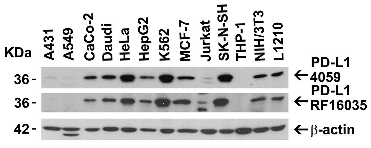 Figure 2 Independent Antibody Validation (IAV) via Protein Expression Profile in Human and Mouse cell lines
Loading: 15 ug of lysates per lane.
Antibodies: 4059 (2 ug/mL) , RF16035 (2 ug/mL) , and beta-actin (1 ug/mL) , 1 h incubation at RT in 5% NFDM/TBST.
Secondary: Goat anti-rabbit and or anti-mouse IgG HRP conjugate at 1:10000 and 1:5000 dilution, respectively.