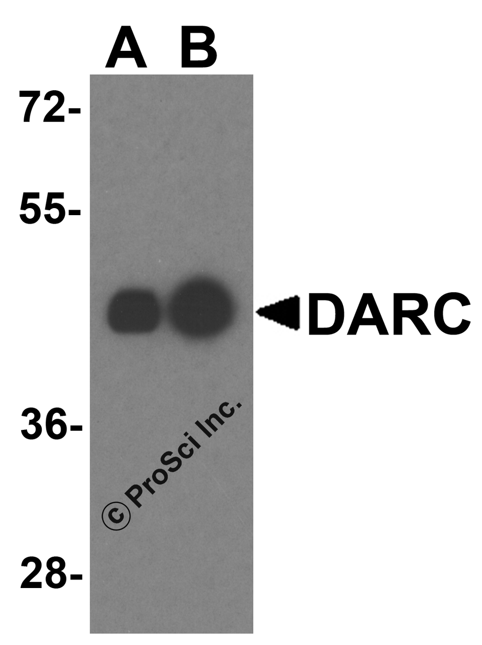 Western blot analysis of DARC in human liver tissue lysate with DARC antibody at (A) 0.25 and (B) 0.5 &#956;g/mL.