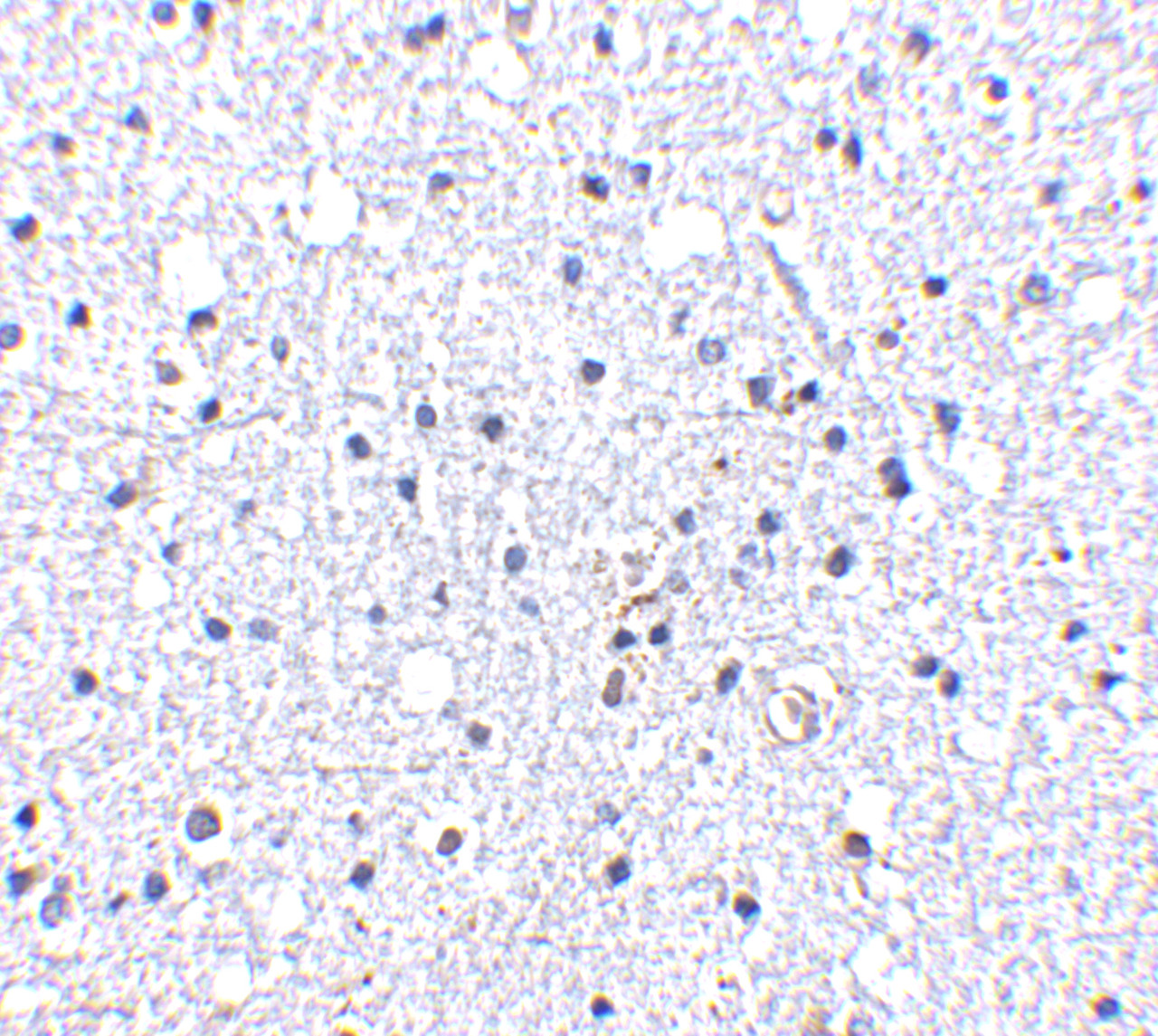 Immunohistochemistry of DARC in human brain tissue with DARC antibody at 5 ug/mL.