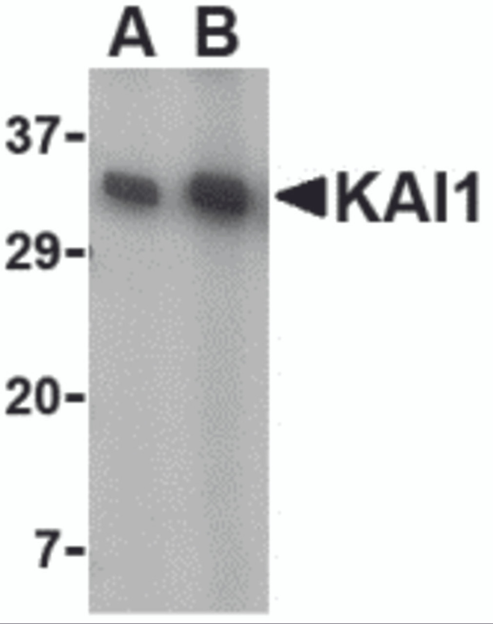 Western blot analysis of KAI1 in A549 cell lysate with KAI1 antibody at (A) 0.5 and (B) 1 &#956;g/mL.