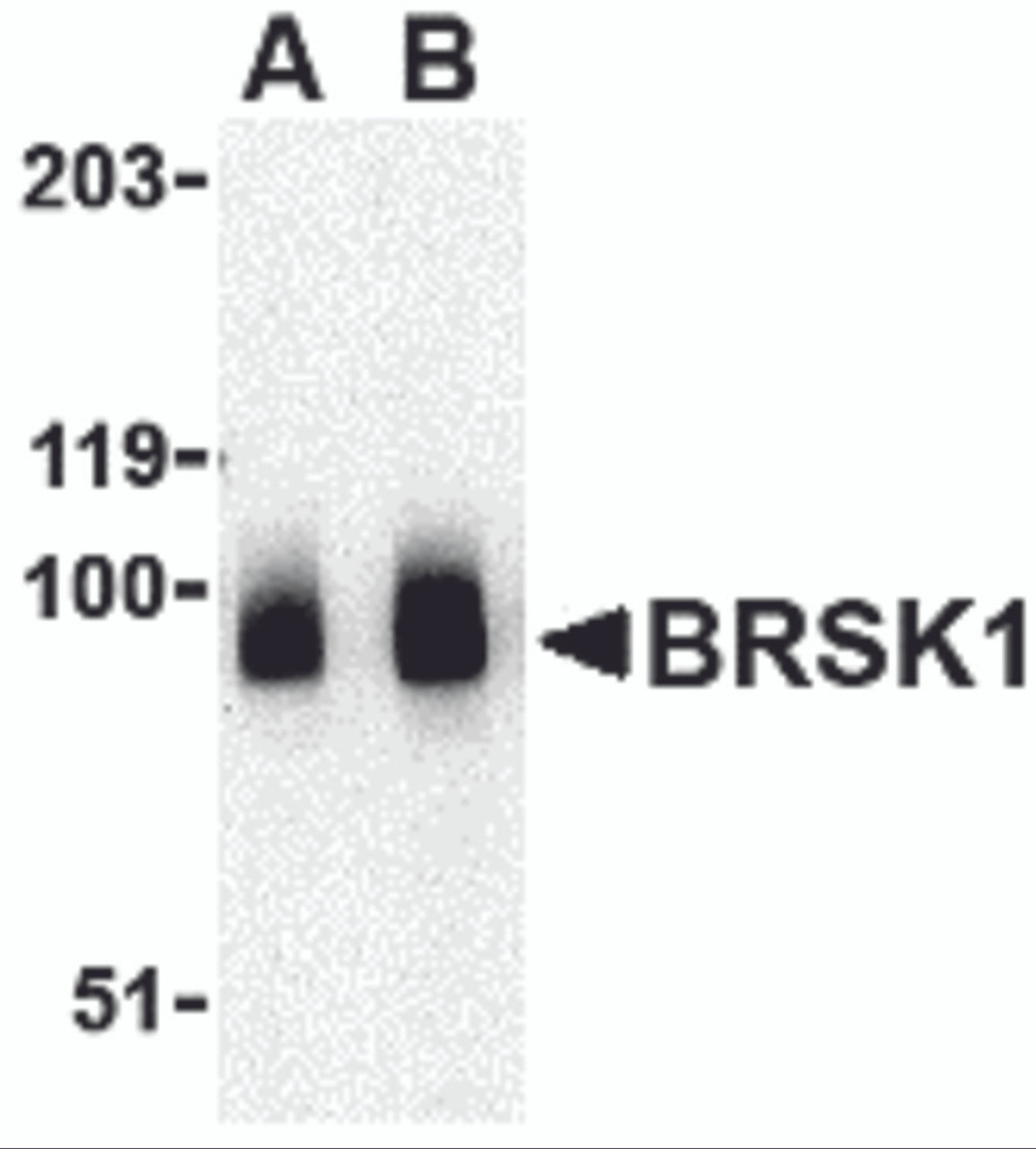 Western blot analysis of BRSK1 in human brain tissue lysate with BRSK1 antibody at (A) 0.5 and (B) 1 &#956;g/mL.