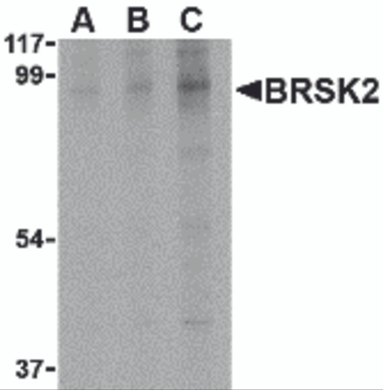 Western blot analysis of BRSK2 in human brain tissue lysate with BRSK2 antibody at (A) 0.5, (B) 1 and (C) 2 &#956;g/mL.