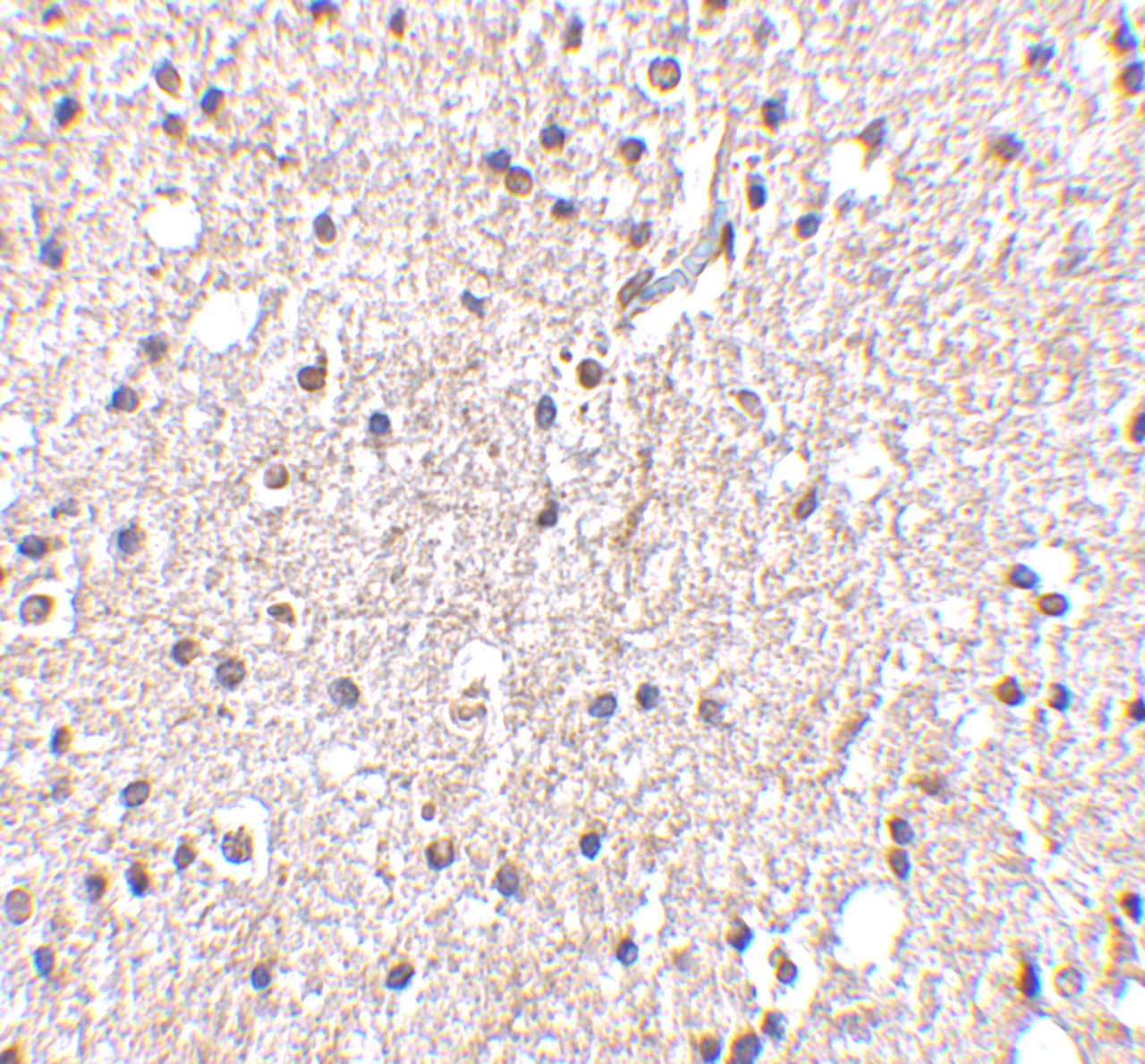 Immunohistochemistry of BRSK2 in human brain tissue with BRSK2 antibody at 5 ug/mL.