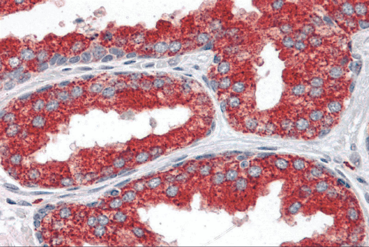 Immunohistochemistry of EMX2 in human prostate tissue with EMX2 antibody at 5 &#956;g/mL.