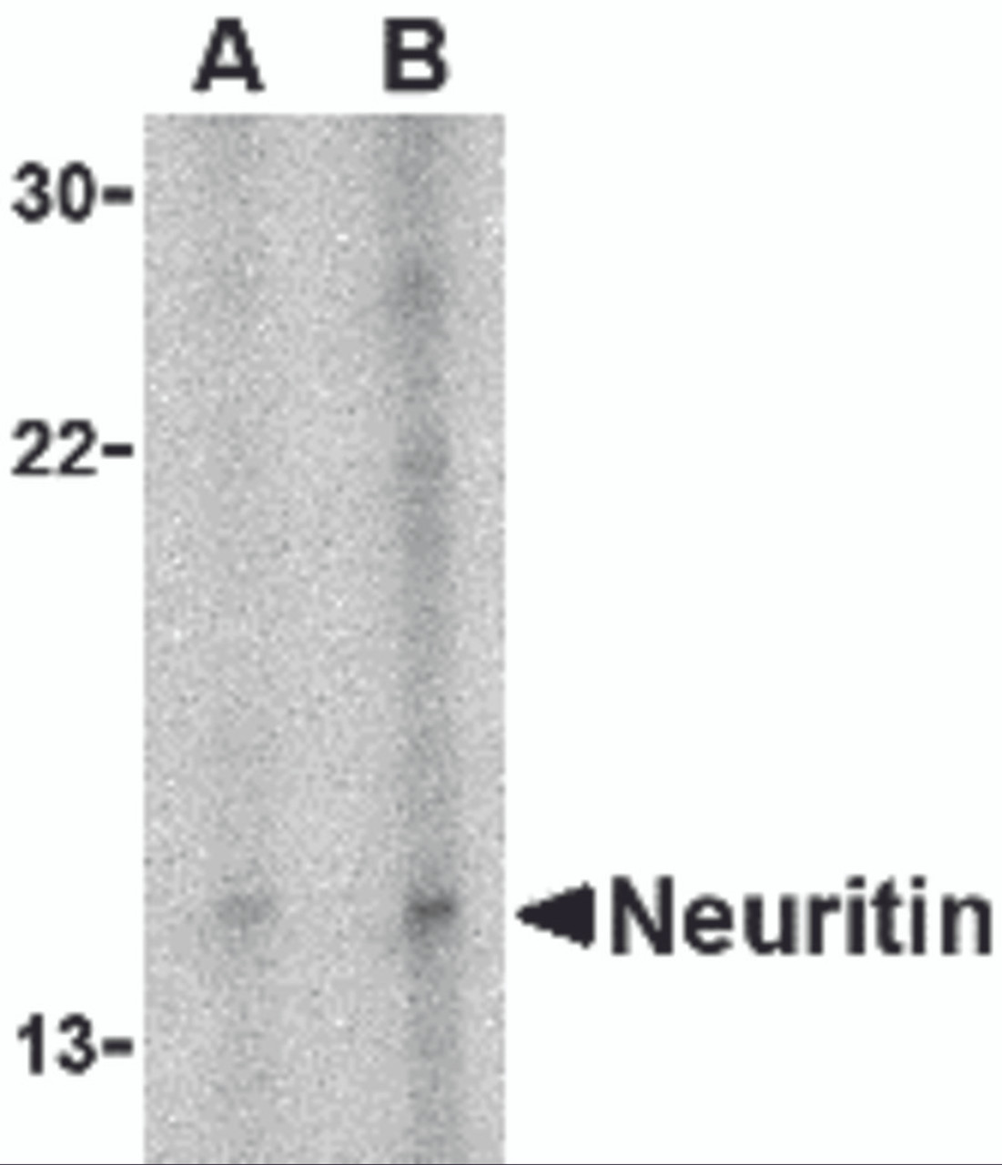 Western blot analysis of neuritin in Daudi cell lysate with neuritin antibody at (A) 5 and (B) 10 &#956;g/mL.