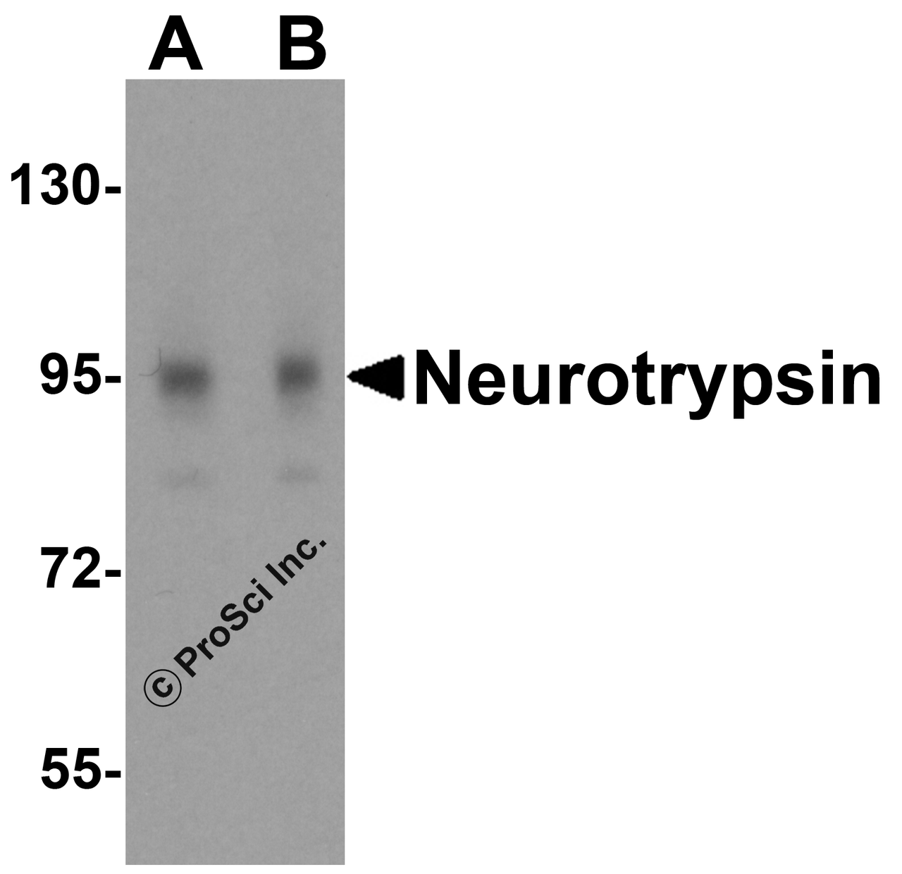 Western blot analysis of neurotrypsin in 3T3 cell lysate with neurotrypsin antibody at (A) 0.25 and (B) 0.5 &#956;g/mL.