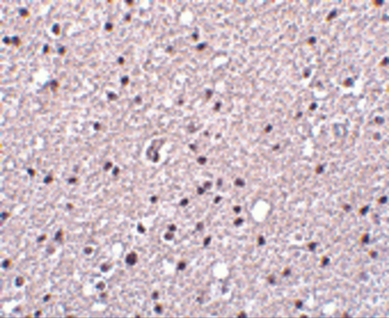 Immunohistochemistry of Neurotrypsin in human brain tissue with Neurotrypsin antibody at 2.5 ug/mL.