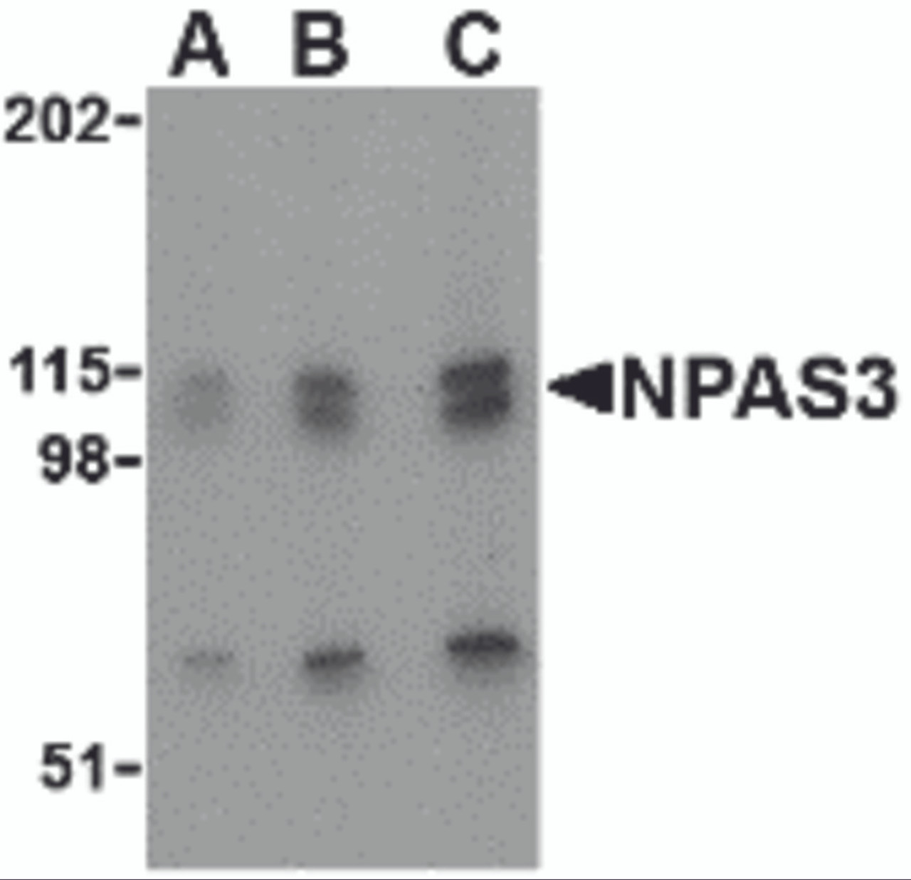 Western blot analysis of NPAS3 in SK-N-SH cell lysate with NPAS3 antibody at (A) 0.5, (B) 1 and (C) 2 &#956;g/mL.