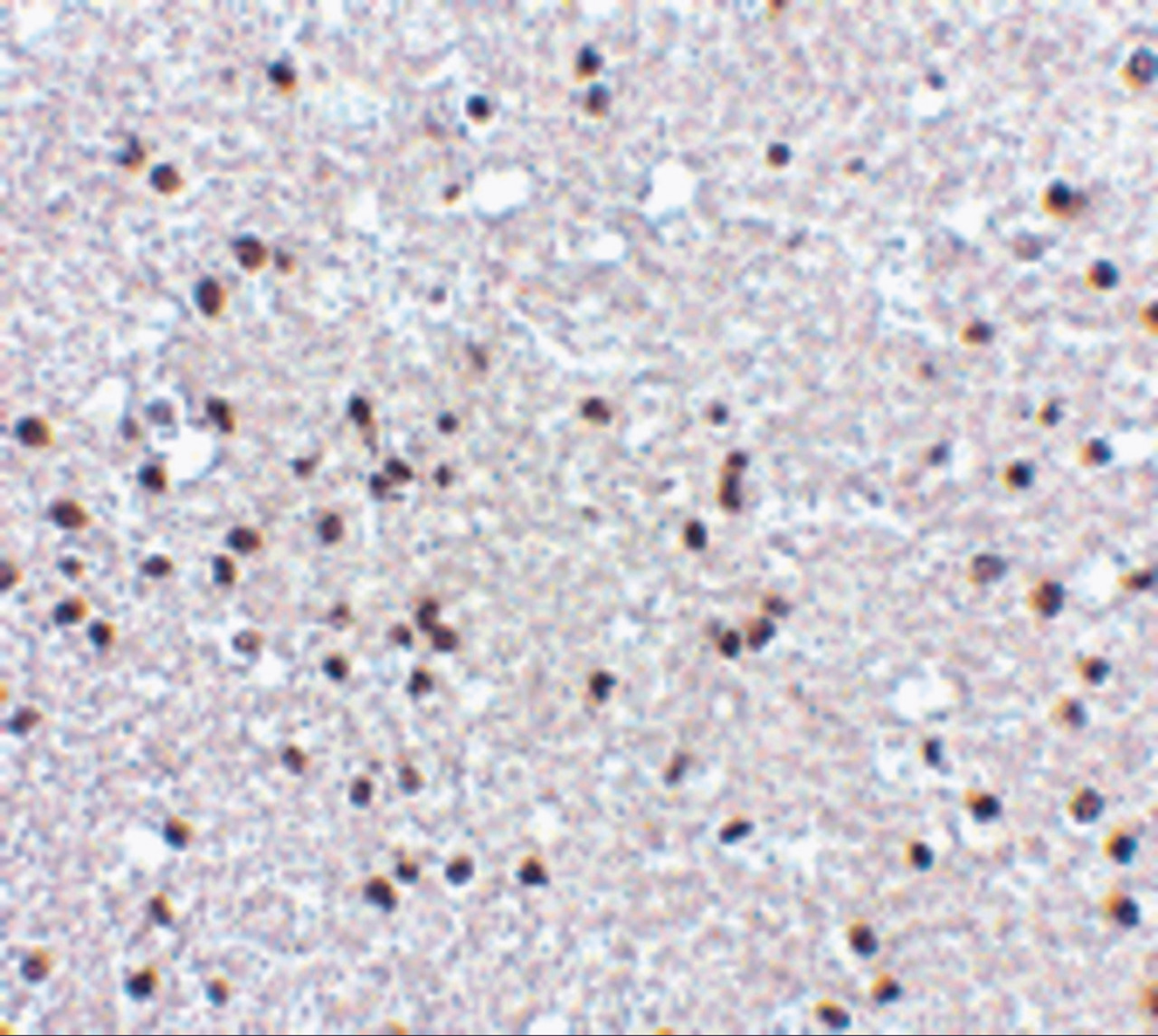 Immunohistochemistry of NPAS3 in human brain tissue with NPAS3 antibody at 5 ug/mL.