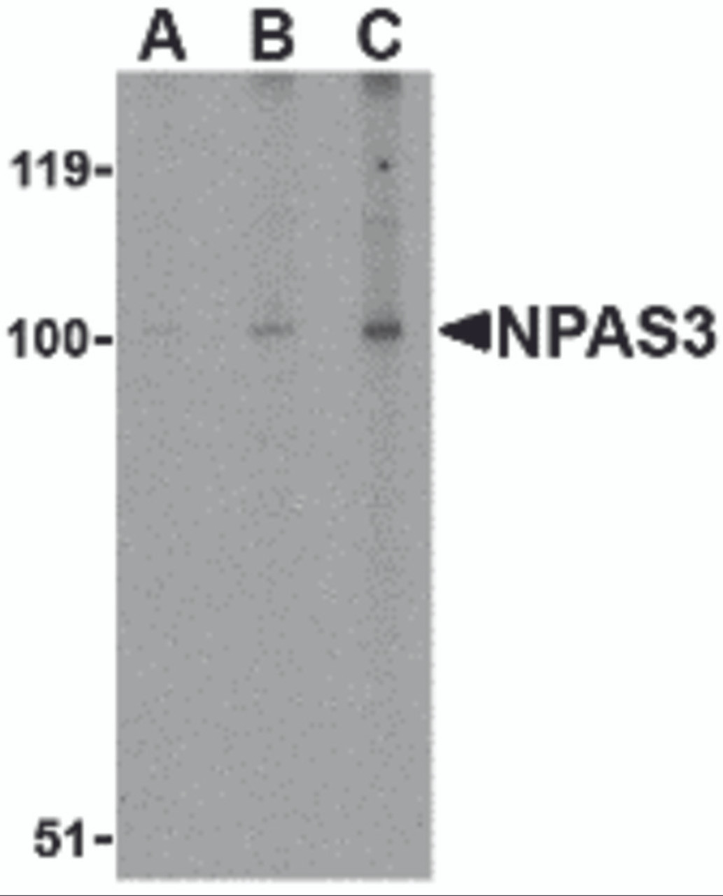 Western blot analysis of NPAS3 in rat brain tissue lysate with NPAS3 antibody at (A) 0.5, (B) 1 and (C) 2 &#956;g/mL.