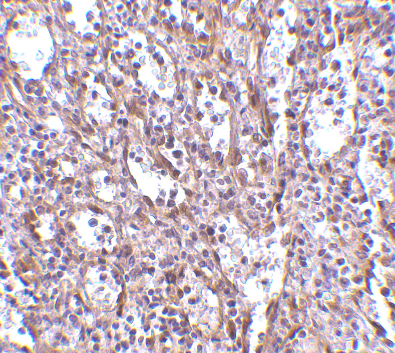 Immunohistochemistry of STIM1 in human spleen tissue with STIM1 antibody at 2.5 ug/mL.