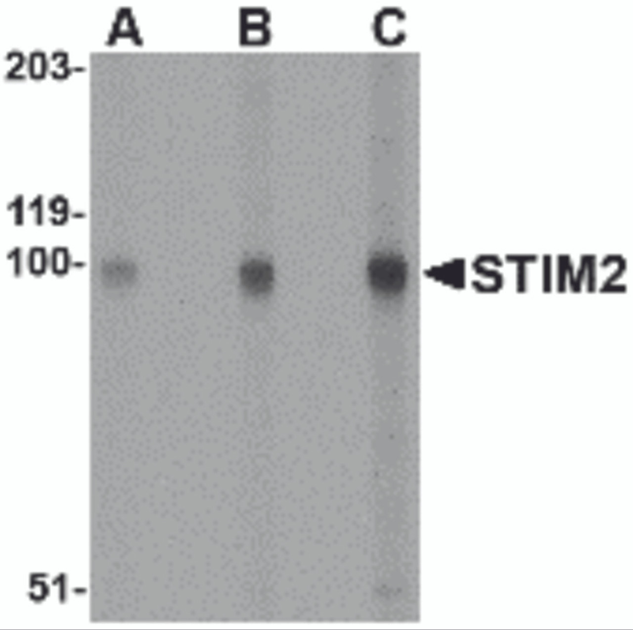 Western blot analysis of STIM2 in A-20 cell lysate with STIM2 antibody at (A) 0.5, (B) 1 and (C) 2 &#956;g/mL.