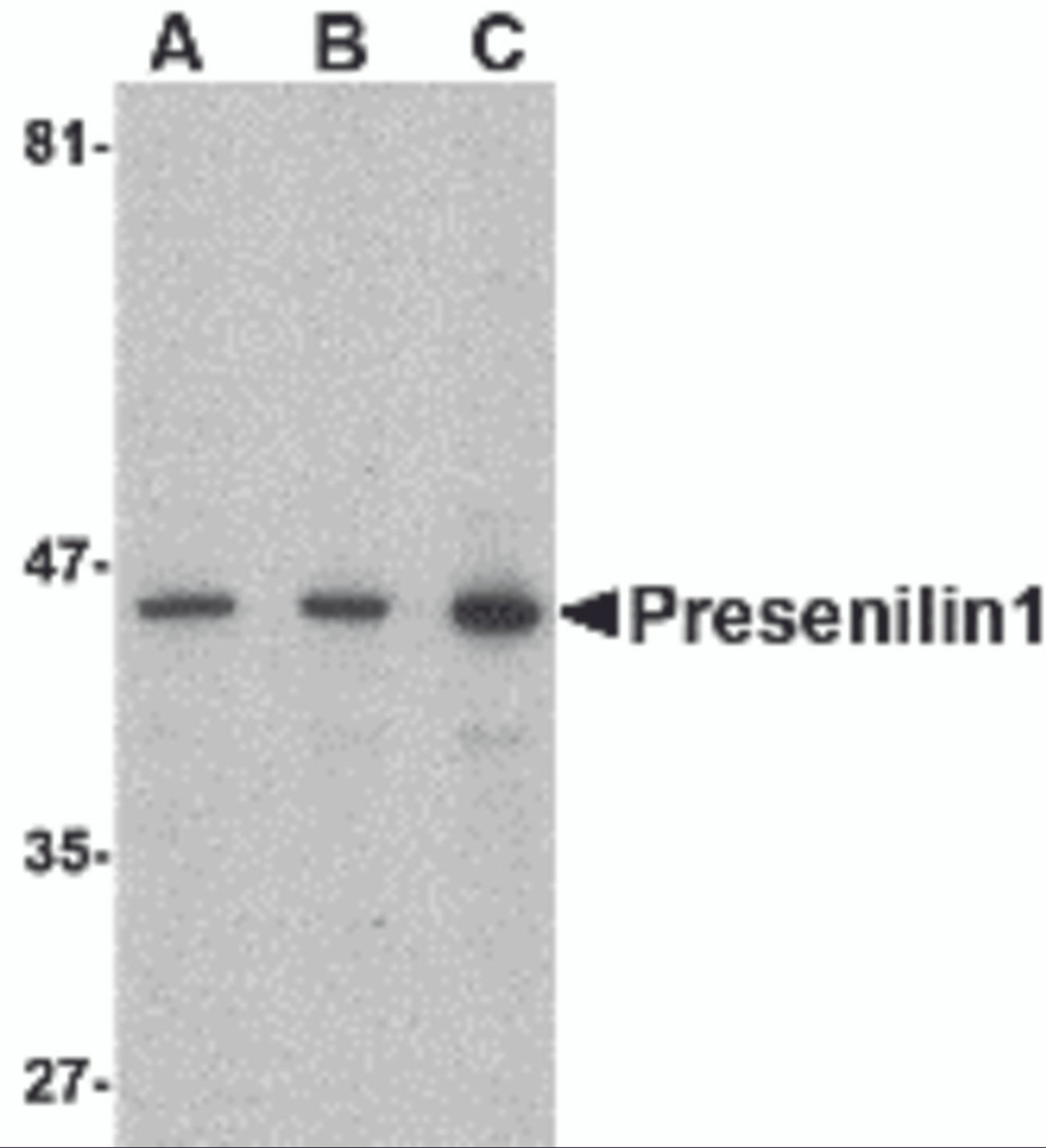 Western blot analysis of presenilin1 in human brain lysate with presenilin1 antibody at (A) 0.5, (B) 1, and (C) 2 &#956;g/mL.