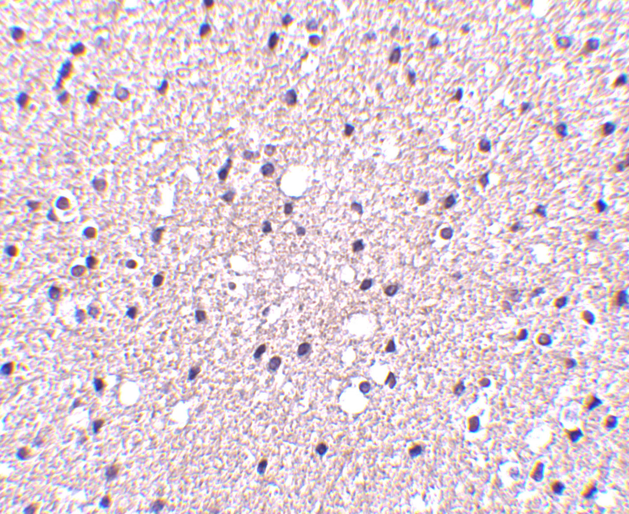 Immunohistochemistry of Presenilin1 in human brain tissue with Presenilin1 antibody at 2.5 ug/mL.