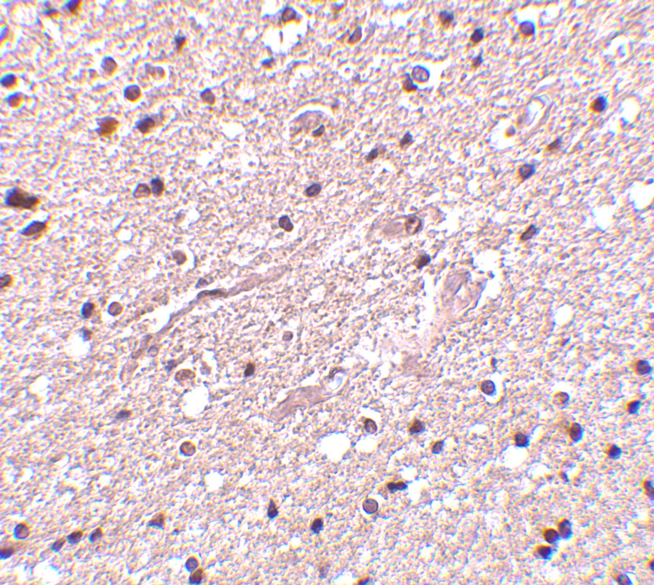 Immunohistochemistry of HAP1 in human brain tissue with HAP1 antibody at 2.5 ug/mL.