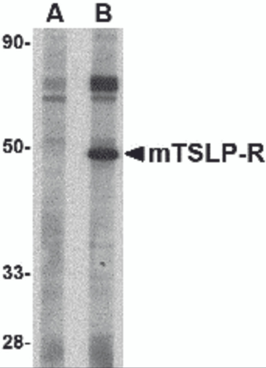 Western blot analysis of TSLP Receptor in mouse heart tissue lysate with TSLP Receptor antibody at 1 &#956;g/mL in (A) the presence and (B) the absence of blocking peptide.