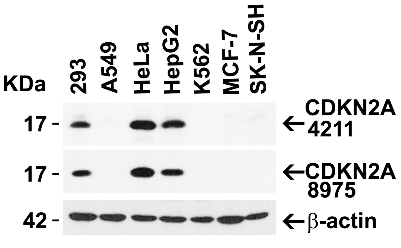 Figure 2 Independent Antibody Validation (IAV) via Protein Expression Profile in Cell Lines
Loading: 15 ug of lysates per lane.
Antibodies: CDKN2A 4211 (4 ug/mL) , CDKN2A 24-023 (4 ug/mL) , and beta-actin (1 ug/mL) , overnight incubation at 4&#730;C in 5% NFDM/TBST.
Secondary: Goat anti-rabbit IgG HRP conjugate at 1:10000 dilution.