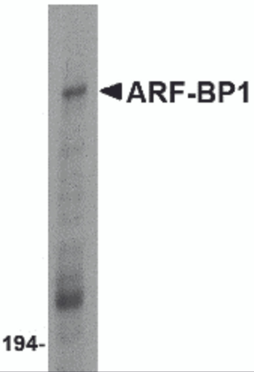 Western blot analysis of ARF-BP1 in Daudi cell lysate with ARF-BP1 antibody at 1 &#956;g/mL.