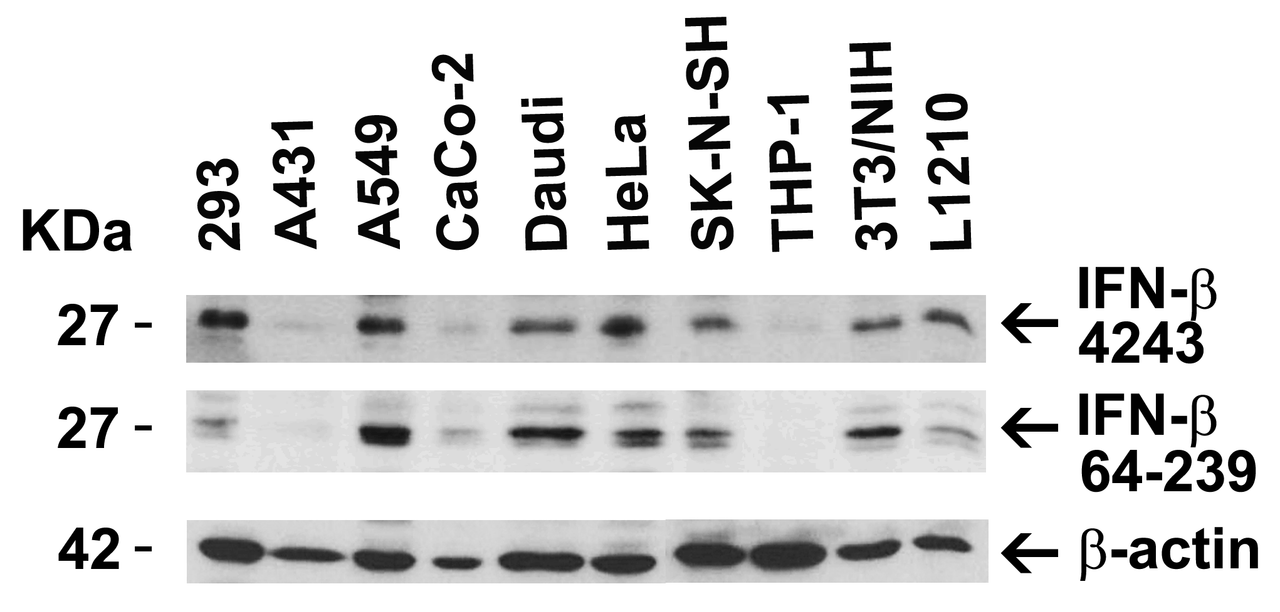 Figure 2 Independent Antibody Validation (IAV) via Protein Expression Profile in Human and Mouse Cell Lines
Loading: 15 ug of lysates per lane.
Antibodies: IFN-beta 4243 (4 ug/mL) , IFN-beta 64-239, (5 ug/mL) and beta-actin 3779 (1 ug/mL) , 1h incubation at RT in 5% NFDM/TBST.
Secondary: Goat anti-rabbit IgG HRP conjugate at 1:10000 dilution.